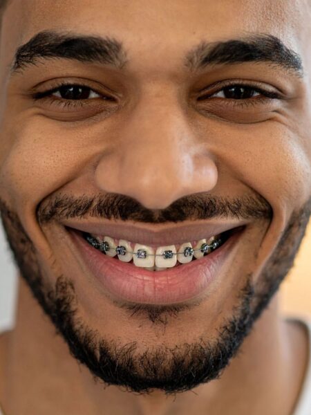 A ortodontia é a área da odontologia responsável por corrigir a posição dos dentes e dos ossos maxilares.